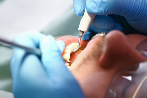 Best Emergency Dental Services for Seniors in Tonkawa, OK