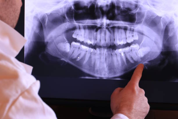 Best Emergency Dental Care for Abscessed Tooth in Tonkawa, OK